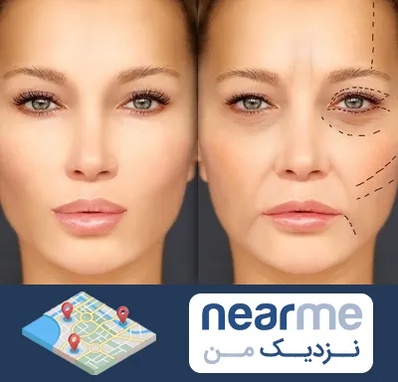 متخصص زیبایی چشم در نزدیک من