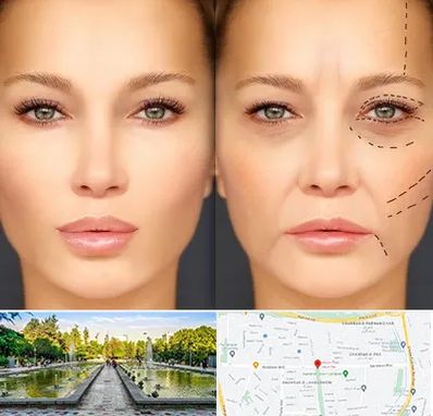 متخصص زیبایی چشم در سرسبز 