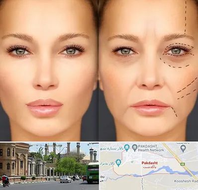 متخصص زیبایی چشم در پاکدشت