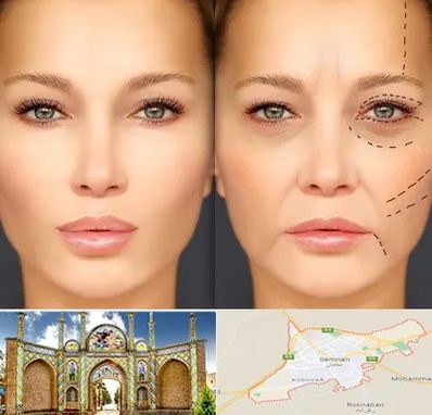 متخصص زیبایی چشم در سمنان