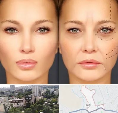 متخصص زیبایی چشم در اوین