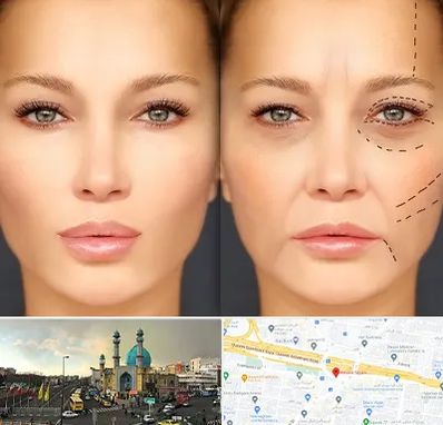 متخصص زیبایی چشم در رسالت 