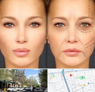 متخصص زیبایی چشم در کوی فیروز تبریز