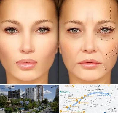 متخصص زیبایی چشم در اندرزگو