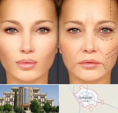 متخصص زیبایی چشم در دهدشت