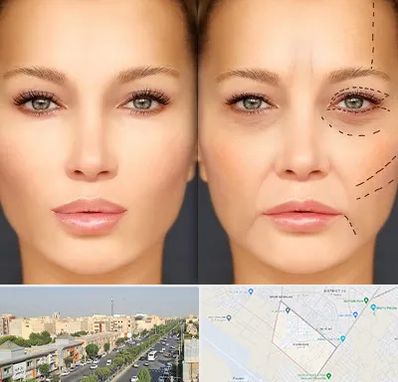 متخصص زیبایی چشم در کیانمهر کرج