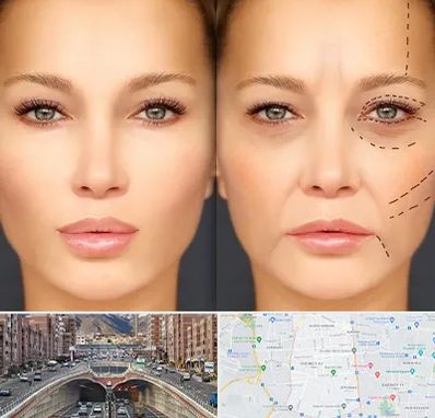 متخصص زیبایی چشم در منطقه 10 تهران 