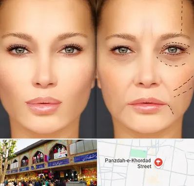 متخصص زیبایی چشم در 15 خرداد