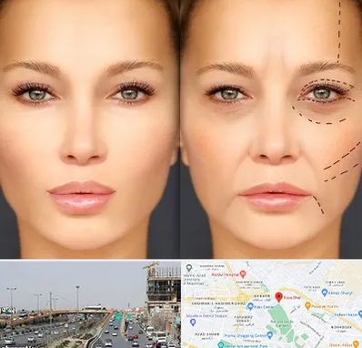 متخصص زیبایی چشم در بلوار توس مشهد 