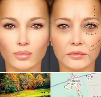 متخصص زیبایی چشم در کردکوی