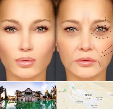 متخصص زیبایی چشم در شیراز