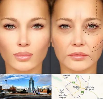 متخصص زیبایی چشم در تایباد