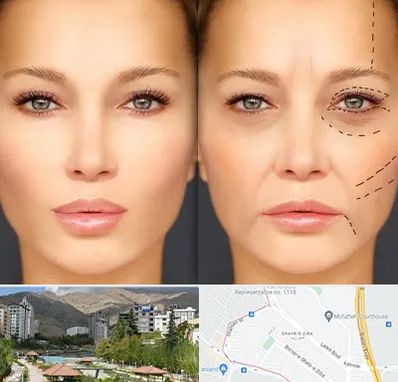 متخصص زیبایی چشم در شهر زیبا 