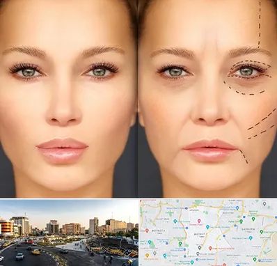 متخصص زیبایی چشم در منطقه 7 تهران 