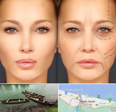 متخصص زیبایی چشم در بندر انزلی