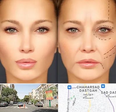 متخصص زیبایی چشم در چهارصد دستگاه 