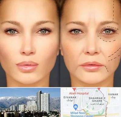 متخصص زیبایی چشم در شهرک غرب 