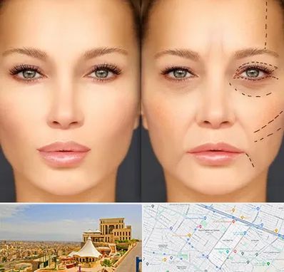 متخصص زیبایی چشم در هاشمیه مشهد