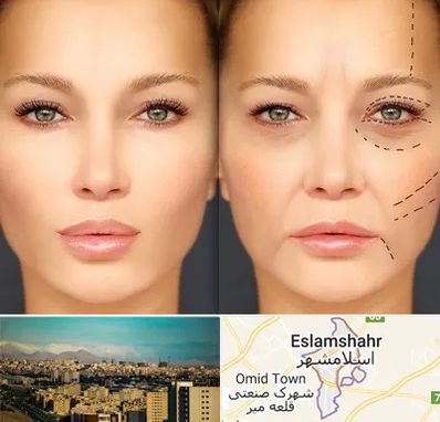 متخصص زیبایی چشم در اسلامشهر