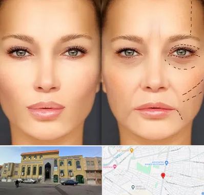 متخصص زیبایی چشم در زنبیل آباد قم