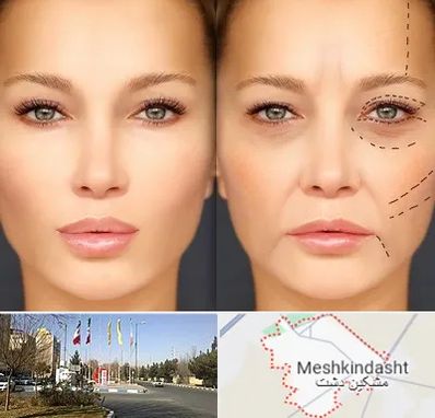 متخصص زیبایی چشم در مشکین دشت