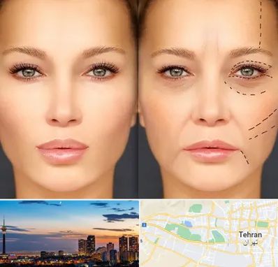 متخصص زیبایی چشم در غرب تهران 
