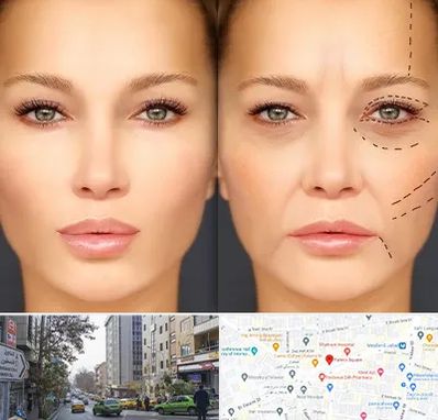 متخصص زیبایی چشم در فاطمی 