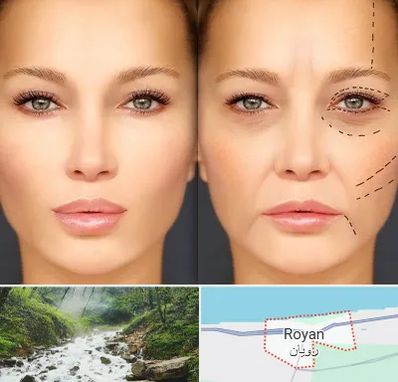 متخصص زیبایی چشم در رویان
