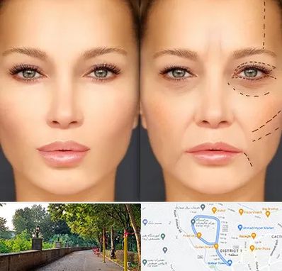 متخصص زیبایی چشم در فلکه گاز رشت