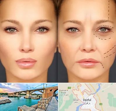 متخصص زیبایی چشم در دزفول