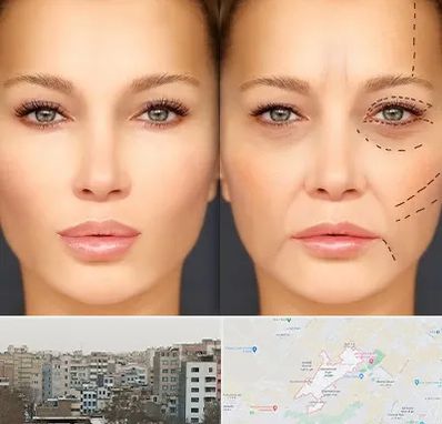 متخصص زیبایی چشم در محمد شهر کرج 