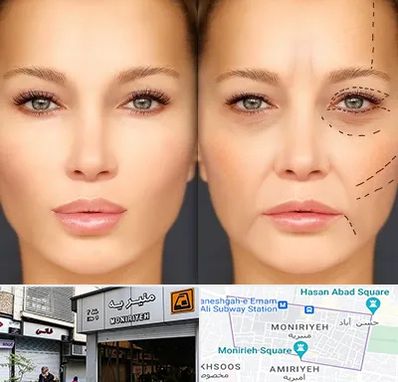متخصص زیبایی چشم در منیریه 