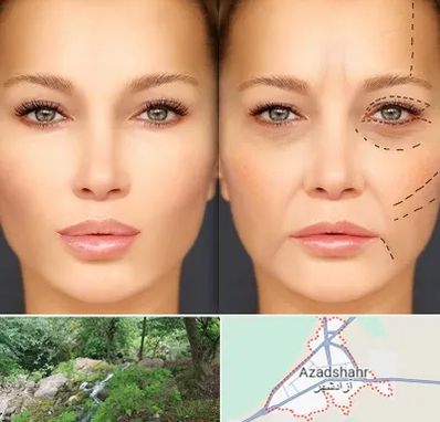 متخصص زیبایی چشم در آزادشهر