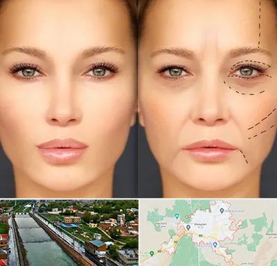 متخصص زیبایی چشم در مراغه