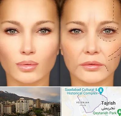 متخصص زیبایی چشم در زعفرانیه 