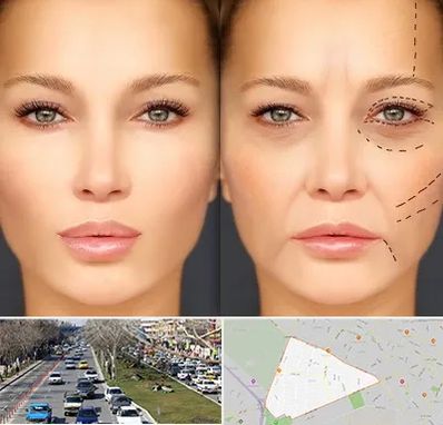 متخصص زیبایی چشم در احمدآباد مشهد 