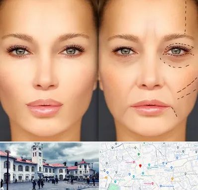 متخصص زیبایی چشم در میدان شهرداری رشت