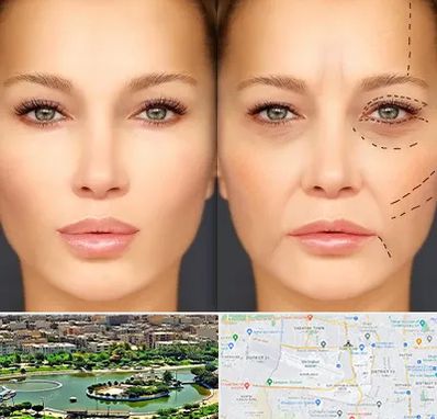 متخصص زیبایی چشم در منطقه 9 تهران 