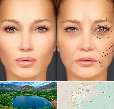 متخصص زیبایی چشم در رودبار