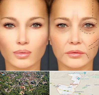 متخصص زیبایی چشم در دماوند