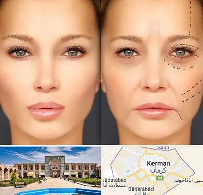 متخصص زیبایی چشم در کرمان