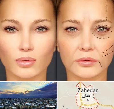 متخصص زیبایی چشم در زاهدان