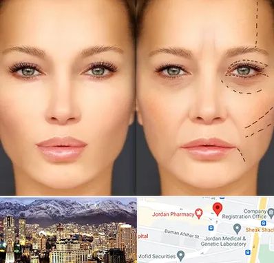 متخصص زیبایی چشم در جردن 