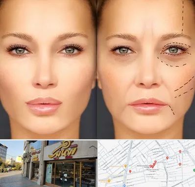 متخصص زیبایی چشم در عطاران قم