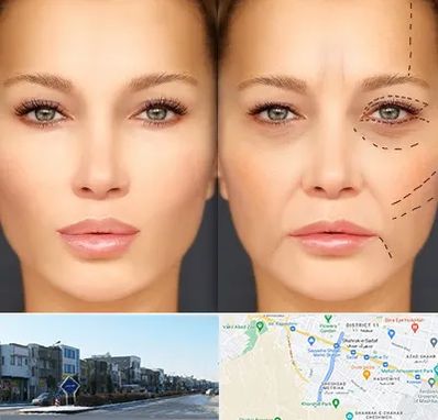 متخصص زیبایی چشم در شریعتی مشهد