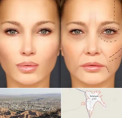 متخصص زیبایی چشم در اسفراین