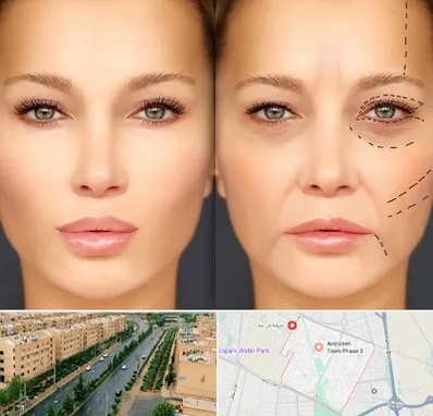 متخصص زیبایی چشم در فاز سه اندیشه