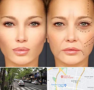 متخصص زیبایی چشم در ظفر 