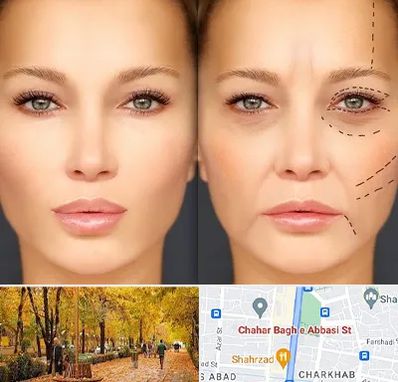 متخصص زیبایی چشم در چهارباغ اصفهان