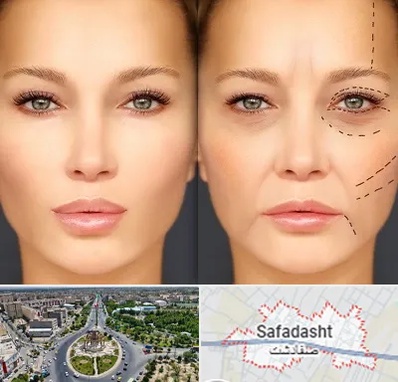 متخصص زیبایی چشم در صفادشت